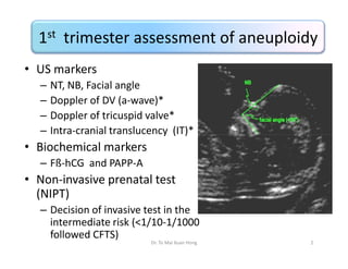 1st trimester assessment of aneuploidy
• US markers
–
–
–
–

NT, NB, Facial angle
Doppler of DV (a-wave)*
Doppler of tricu...