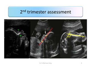 2nd trimester assessment

Dr. To Mai Xuan Hong

8

 