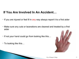 City of Glasgow College 17
If You Are Involved In An Accident…
• If you are injured or feel ill in any way always report it to a first aider
• Make sure any cuts or lacerations are cleaned and treated by a first
aider
• If not your hand could go from looking like this…
• To looking like this…
 