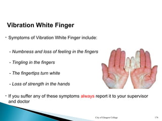 City of Glasgow College 174
- Numbness and loss of feeling in the fingers
- Tingling in the fingers
Vibration White Finger
• Symptoms of Vibration White Finger include:
- The fingertips turn white
• If you suffer any of these symptoms always report it to your supervisor
and doctor
- Loss of strength in the hands
 