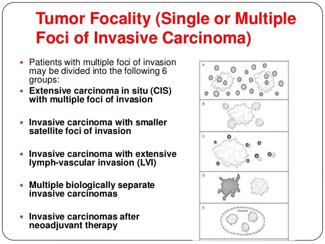 Pathologic Reporting Of Breast Specimens