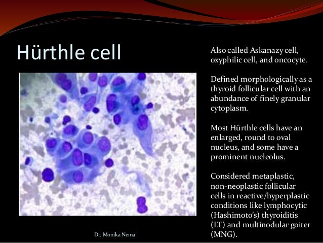 Reporting thyroid fine needle aspiration by the bethesda 