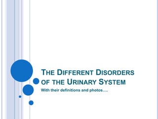 THE DIFFERENT DISORDERS
OF THE URINARY SYSTEM
With their definitions and photos….
 