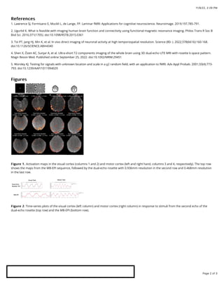 Submillimeter fMRI Acquisition using a dual-echo Rosette kspace ...