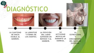 Labio Reposo REPOSICION LABIAL en odontologia tecnicas | PPTX