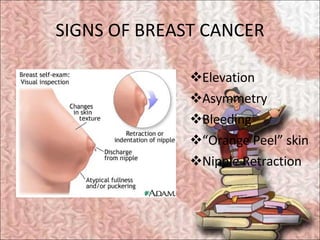 SIGNS OF BREAST CANCER <ul><li>Elevation </li></ul><ul><li>Asymmetry </li></ul><ul><li>Bleeding </li></ul><ul><li>“Orange ...