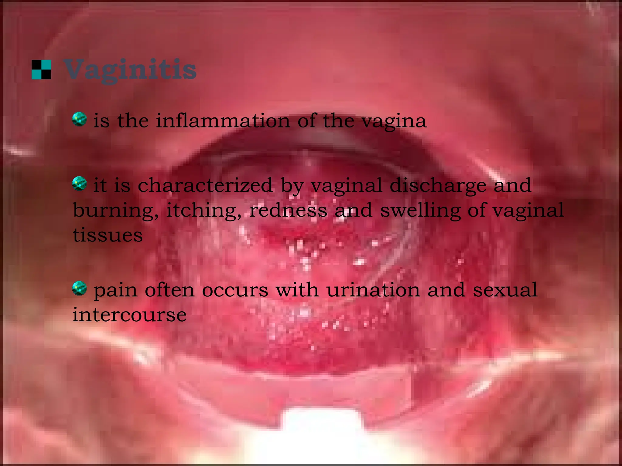 REPRODUCTIVE TOPIC - QSU HEALTH SERVICES.pptx