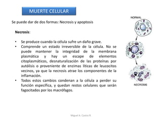 Se puede dar de dos formas: Necrosis y apoptosis
Necrosis:
• Se produce cuando la célula sufre un daño grave.
• Comprende un estado irreversible de la célula. No se
puede mantener la integridad de la membrana
plasmática y hay un escape de elementos
citoplasmáticos, desnaturalización de las proteínas por
autólisis o proveniente de enzimas líticas de leucocitos
vecinos, ya que la necrosis atrae los componentes de la
inflamación.
• Todos estos cambios condenan a la célula a perder su
función específica, y quedan restos celulares que serán
fagocitados por los macrófagos.
MUERTE CELULAR
Miguel A. Castro R.
 