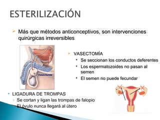 

Más que métodos anticonceptivos, son intervenciones
quirúrgicas irreversibles




VASECTOMÍA

Se seccionan los conductos deferentes

Los espermatozoides no pasan al
semen

El semen no puede fecundar

LIGADURA DE TROMPAS
◦ Se cortan y ligan las trompas de falopio
◦ El óvulo nunca llegará al útero

 