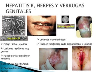 Herpes genital

Hepatitis B
 Fatiga, fiebre, ictericia
 Lesiones hepáticas muy
graves
 Puede derivar en cáncer
hepático
VERRUGAS GENITALES
 Pueden derivar en cáncer
genital

 Lesiones muy dolorosas
 Pueden reactivarse cada cierto tiempo  crónica

 