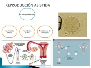 En casos de esterilidad

Inseminación
artificial

Fecundación
in vitro

Transferencia de
embriones

 