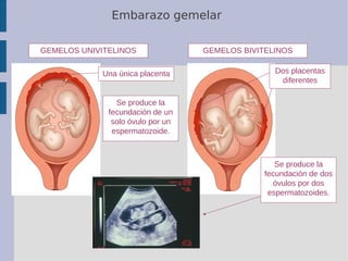 Embarazo gemelar
GEMELOS UNIVITELINOS GEMELOS BIVITELINOS
Una única placenta Dos placentas
diferentes
Se produce la
fecund...
