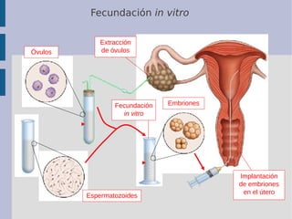 Fecundación in vitro
Embriones
Espermatozoides
Óvulos
Extracción
de óvulos
Fecundación
in vitro
Implantación
de embriones
...