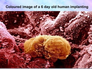 Coloured image of a 6 day old human implanting  * Nafly Hussain* 