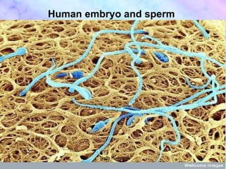 Human embryo and sperm * Nafly Hussain* 