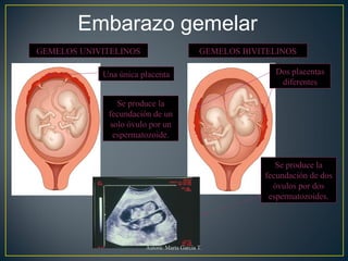 Embarazo gemelar
GEMELOS UNIVITELINOS GEMELOS BIVITELINOS
Una única placenta Dos placentas
diferentes
Se produce la
fecundación de un
solo óvulo por un
espermatozoide.
Se produce la
fecundación de dos
óvulos por dos
espermatozoides.
Autora: Marta García T.
 