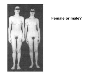 Female or male? 