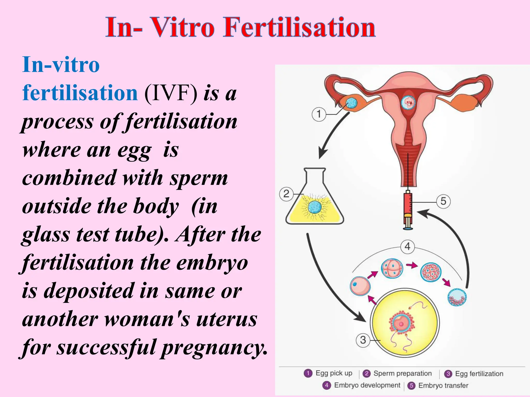 In-vitro
fertilisation (IVF) is a
process of fertilisation
where an egg is
combined with sperm
outside the body (in
glass test tube). After the
fertilisation the embryo
is deposited in same or
another woman's uterus
for successful pregnancy.
 