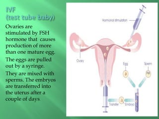 Ovaries are
stimulated by FSH
hormone that causes
production of more
than one mature egg.
The eggs are pulled
out by a syringe.
They are mixed with
sperms. The embryos
are transferred into
the uterus after a
couple of days.
 
