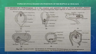 TYPES OF OVULE BASED ON POSITION OF MICROPYLE & CHALAZA
 