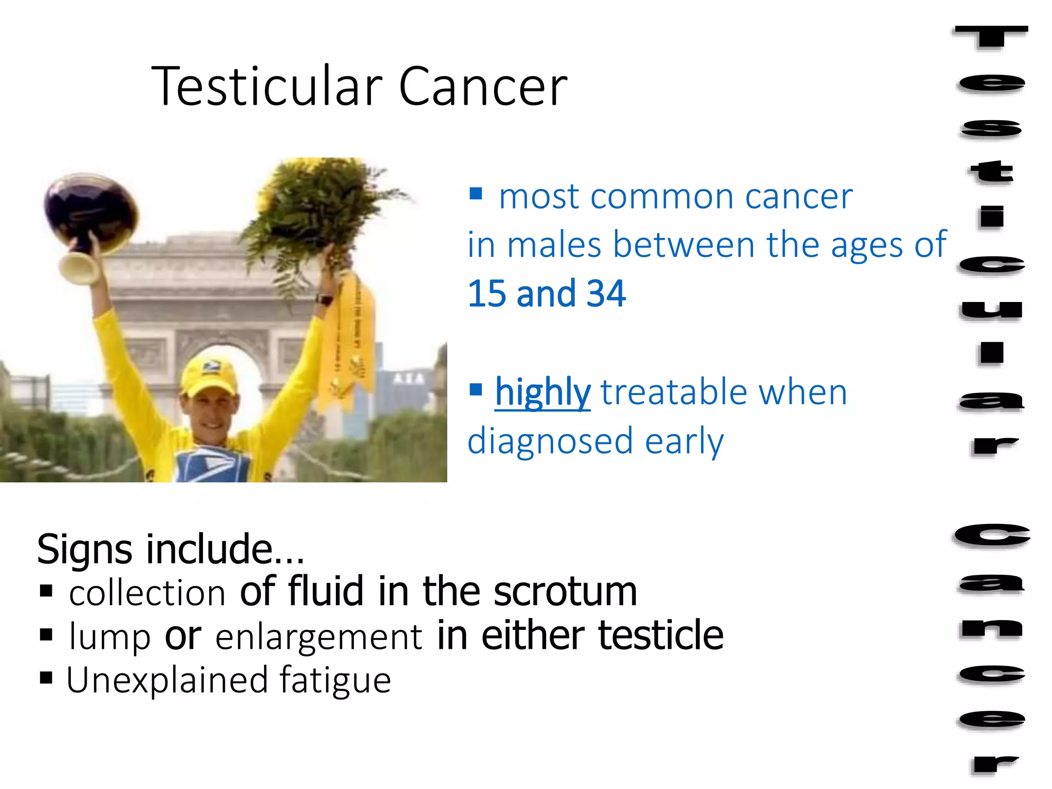 Testicular Cancer
 most common cancer
in males between the ages of
15 and 34
 highly treatable when
diagnosed early
Signs include…
 collection of fluid in the scrotum
 lump or enlargement in either testicle
 Unexplained fatigue
 