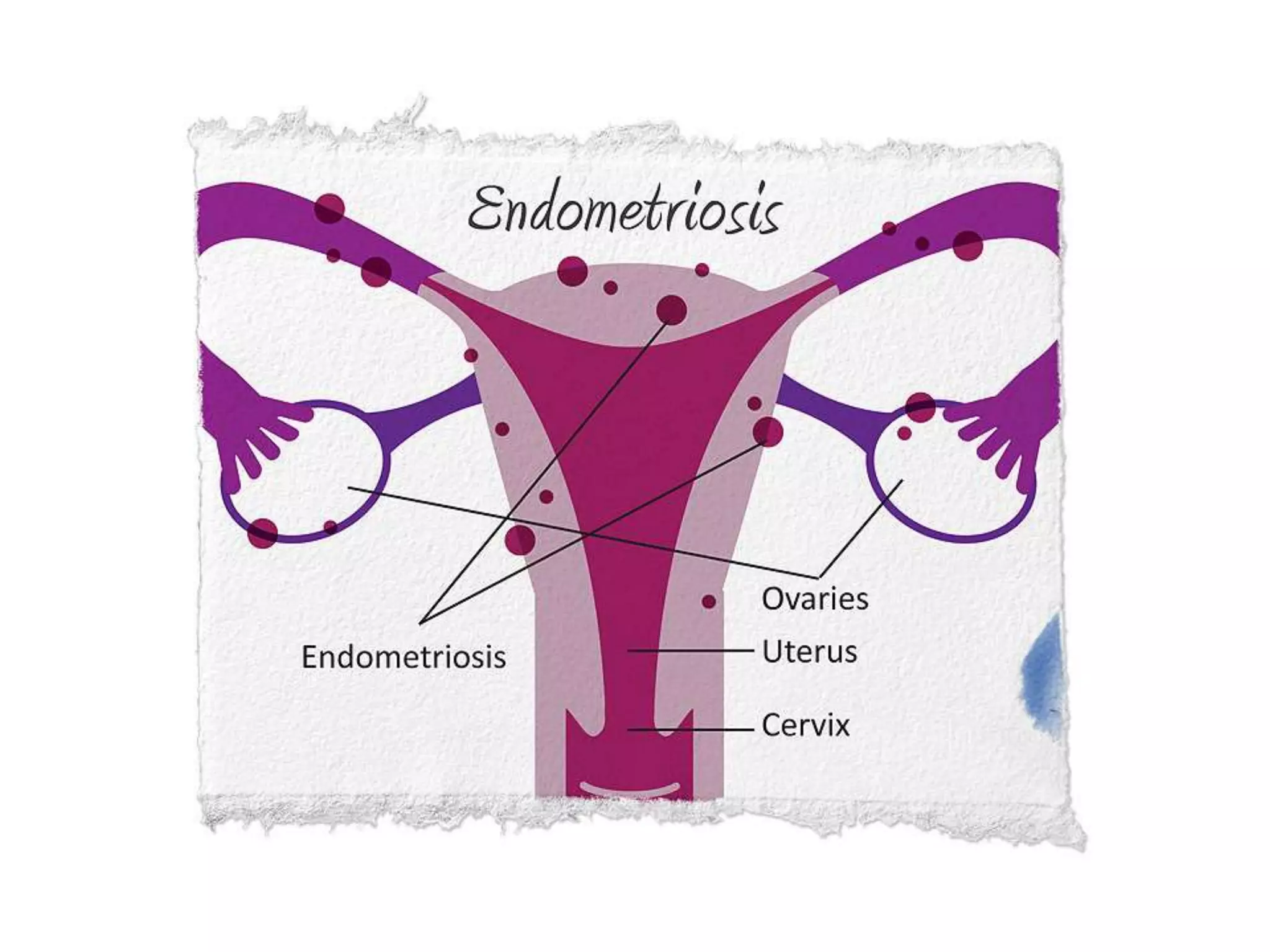 Reproductive-System.ppt
