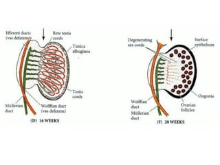 Sexual Differentiation During Development and Gonadal Dysgenesis | PPTX