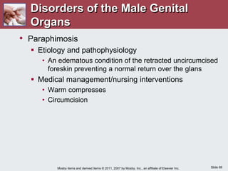 Slide 66
Mosby items and derived items © 2011, 2007 by Mosby, Inc., an affiliate of Elsevier Inc.
Disorders of the Male Genital
Organs
• Paraphimosis
 Etiology and pathophysiology
• An edematous condition of the retracted uncircumcised
foreskin preventing a normal return over the glans
 Medical management/nursing interventions
• Warm compresses
• Circumcision
 