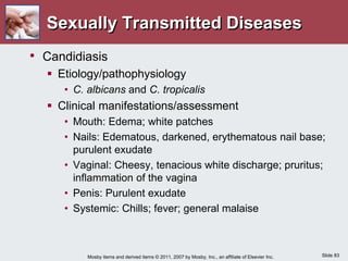 Slide 83
Mosby items and derived items © 2011, 2007 by Mosby, Inc., an affiliate of Elsevier Inc.
Sexually Transmitted Diseases
• Candidiasis
 Etiology/pathophysiology
• C. albicans and C. tropicalis
 Clinical manifestations/assessment
• Mouth: Edema; white patches
• Nails: Edematous, darkened, erythematous nail base;
purulent exudate
• Vaginal: Cheesy, tenacious white discharge; pruritus;
inflammation of the vagina
• Penis: Purulent exudate
• Systemic: Chills; fever; general malaise
 