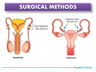 SURGICAL METHODS
Jupion Classes
 