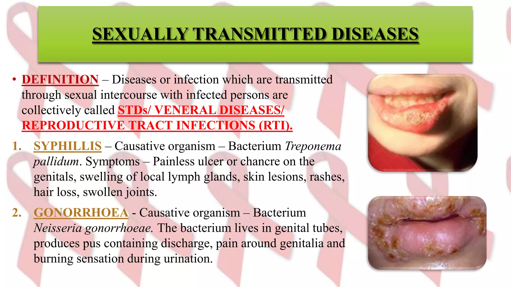 Sexual Rashes Reproductive health | PPTX