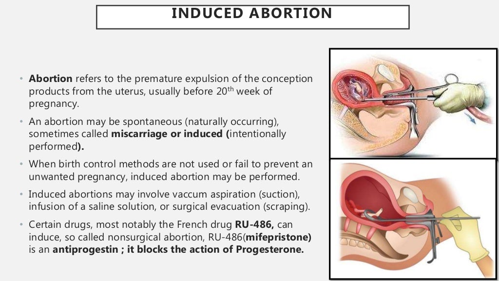 assignment on reproductive health class 12