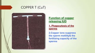 COPPER T (CuT)
Function of copper
releasing IUD
1. Phagocytosis of the
sperms
2.Copper ions suppress
the sperm motility& the
fertilizing capacity of the
sperms
 