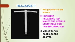 PROGESTASERT
1.Phagocytosis of the
sperms
2.HORMONE
RELEASING IUD
MAKES THE UTERUS
UNSUITABLE FOR
THE IMPLANTATION
3.Makes cervix
hostile to the
sperms.
 
