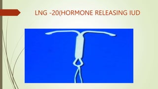 LNG -20(HORMONE RELEASING IUD
 