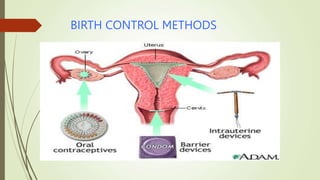 BIRTH CONTROL METHODS
 