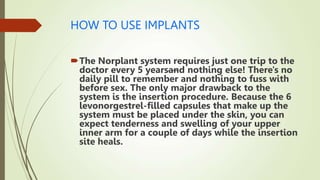 HOW TO USE IMPLANTS
The Norplant system requires just one trip to the
doctor every 5 years—
and nothing else! There's no
daily pill to remember and nothing to fuss with
before sex. The only major drawback to the
system is the insertion procedure. Because the 6
levonorgestrel-filled capsules that make up the
system must be placed under the skin, you can
expect tenderness and swelling of your upper
inner arm for a couple of days while the insertion
site heals.
 