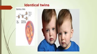 Identical twins
 