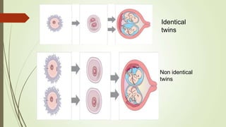 Identical
twins
Non identical
twins
 