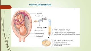 STEPS IN AMNIOCENTESIS
 
