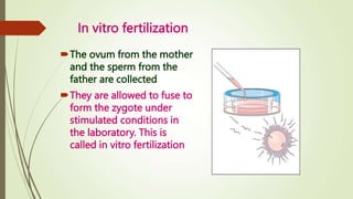 In vitro fertilization
The ovum from the mother
and the sperm from the
father are collected
They are allowed to fuse to
form the zygote under
stimulated conditions in
the laboratory. This is
called in vitro fertilization
 