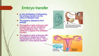 Embryo transfer
 In vitro fertilization is followed by
the embryo transfer into the
uterus or fallopian tube
 The zygote is allowed to form
embryo
 The zygote or early embryoes with
8 blastomers will be transferred
into the fallopian tube . This is
called ZIFT( Zygote intra fallopiasn
transfer)
 The zygote or early embryoes with
more than 8 blastomers will be
transferred into the uterus . This is
called IUT ( Intra uterine transfer)
 