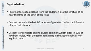 info@medicoseacademics.com
0310-7990649
Dr. Sidra Arshad, Asst. Prof. Physiology 10
Cryptorchidism:
• Failure of testes to descend from the abdomen into the scrotum at or
near the time of the birth of the fetus
• Descent occurs in the last 2-3 months of gestation under the influence
of fetal testosterone
• Descent is incomplete on one or, less commonly, both sides in 10% of
newborn males, with the testes remaining in the abdominal cavity or
inguinal canal
 