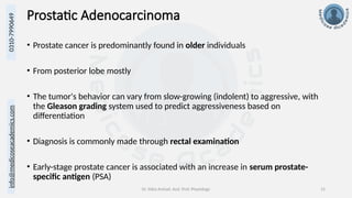 info@medicoseacademics.com
0310-7990649
Dr. Sidra Arshad, Asst. Prof. Physiology 15
Prostatic Adenocarcinoma
• Prostate cancer is predominantly found in older individuals
• From posterior lobe mostly
• The tumor's behavior can vary from slow-growing (indolent) to aggressive, with
the Gleason grading system used to predict aggressiveness based on
differentiation
• Diagnosis is commonly made through rectal examination
• Early-stage prostate cancer is associated with an increase in serum prostate-
specific antigen (PSA)
 