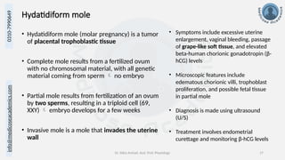 info@medicoseacademics.com
0310-7990649
Dr. Sidra Arshad, Asst. Prof. Physiology 17
Hydatidiform mole
• Hydatidiform mole (molar pregnancy) is a tumor
of placental trophoblastic tissue
• Complete mole results from a fertilized ovum
with no chromosomal material, with all genetic
material coming from sperm  no embryo
• Partial mole results from fertilization of an ovum
by two sperms, resulting in a triploid cell (69,
XXY)  embryo develops for a few weeks
• Invasive mole is a mole that invades the uterine
wall
• Symptoms include excessive uterine
enlargement, vaginal bleeding, passage
of grape-like soft tissue, and elevated
beta-human chorionic gonadotropin (β-
hCG) levels
• Microscopic features include
edematous chorionic villi, trophoblast
proliferation, and possible fetal tissue
in partial mole
• Diagnosis is made using ultrasound
(U/S)
• Treatment involves endometrial
curettage and monitoring β-hCG levels
 