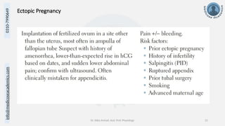 info@medicoseacademics.com
0310-7990649
Dr. Sidra Arshad, Asst. Prof. Physiology 21
Ectopic Pregnancy
 