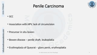 info@medicoseacademics.com
0310-7990649
Dr. Sidra Arshad, Asst. Prof. Physiology 9
Penile Carcinoma
• SCC
• Association with HPV, lack of circumcision
• Precursor in situ lesion:
• Bowen disease – penile shaft, leukoplakia
• Erythroplasia of Queyrat – glans penis, erythroplakia
 