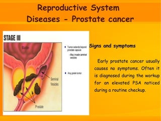 Reproductive System
Diseases - Prostate cancer
Signs and symptoms
Early prostate cancer usually
causes no symptoms. Often it
is diagnosed during the workup
for an elevated PSA noticed
during a routine checkup.
 
