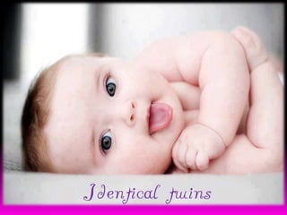 Identical twins

 