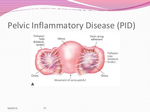 reproductive system 2014 reproductive system diseases